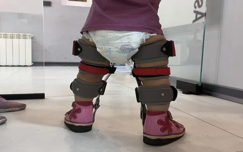 بریس پا کودکان 