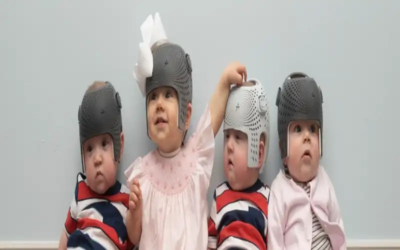 خرید کلاه فرم دهی سر نوزاد