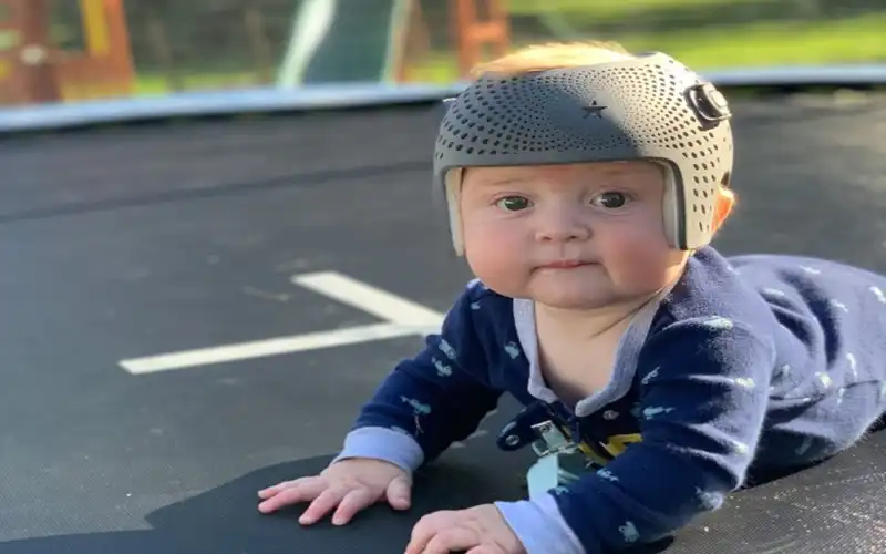 قیمت کلاه فرم دهی سر نوزاد