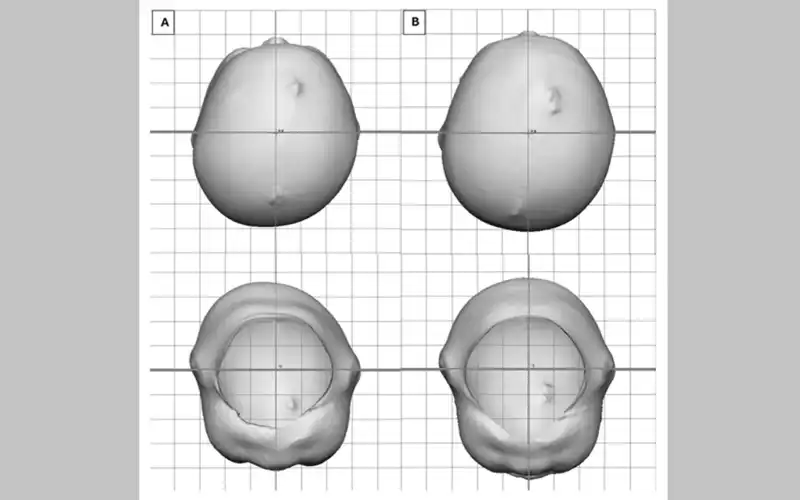 کلاه فرمدهی
