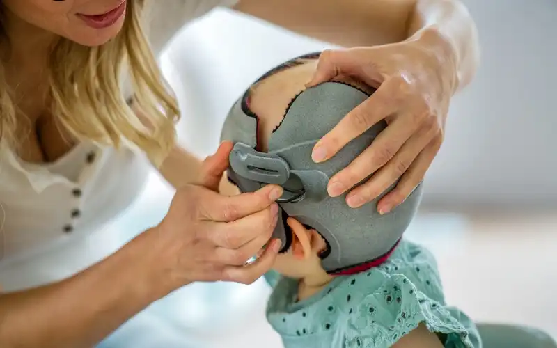 ناهنجاریهای جمجمه