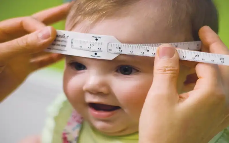 طراحی ارتز جمجمه