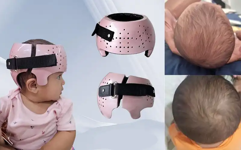 انواع کلاه فرمدهی سر