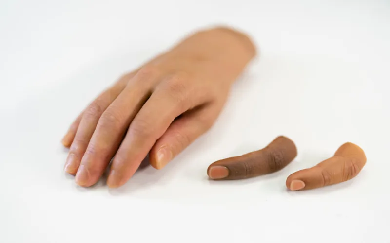 پروتز انگشت 