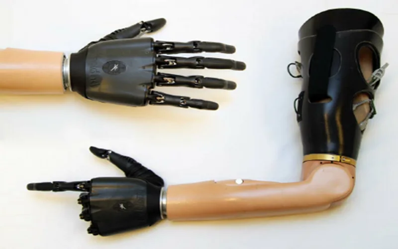 انواع پروتز بالای آرنج