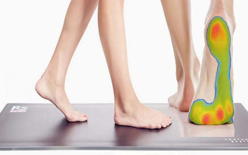 انواع اسکن کف پا