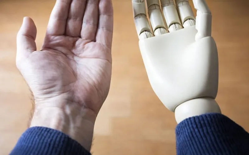 پروتز مکانیکی 