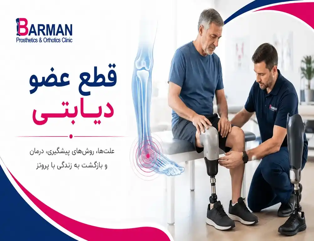 قطع عضو دیابتی