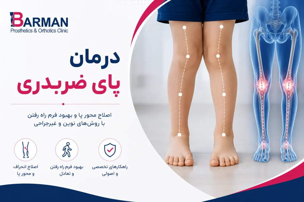 درمان پای ضربدری