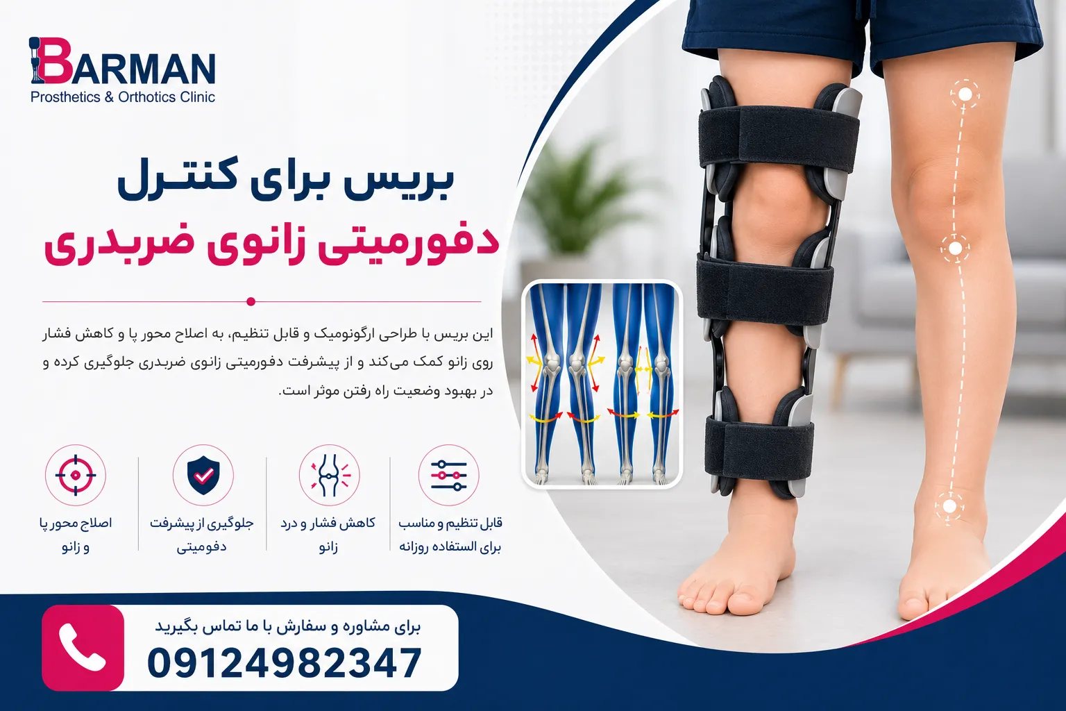 زانوبند طبی ضد ضربدری