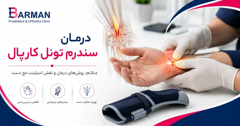 درمان سندورم تونل کارپال