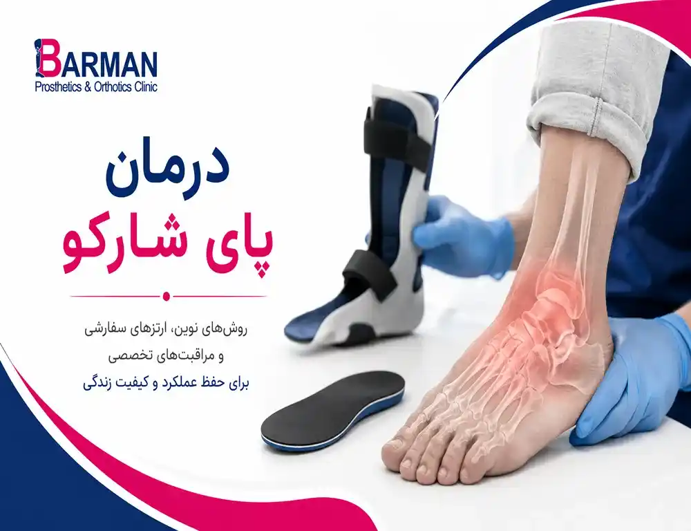 درمان پای شارکو