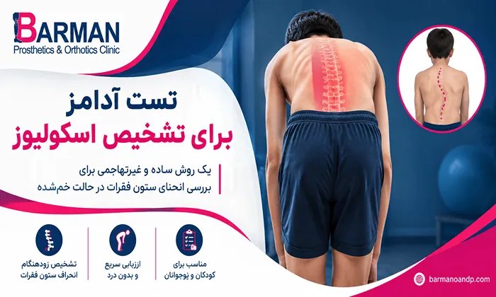تست آدامز