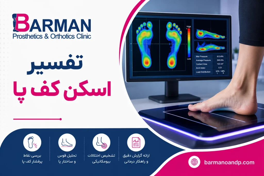 تفسیر اسکن کف پا