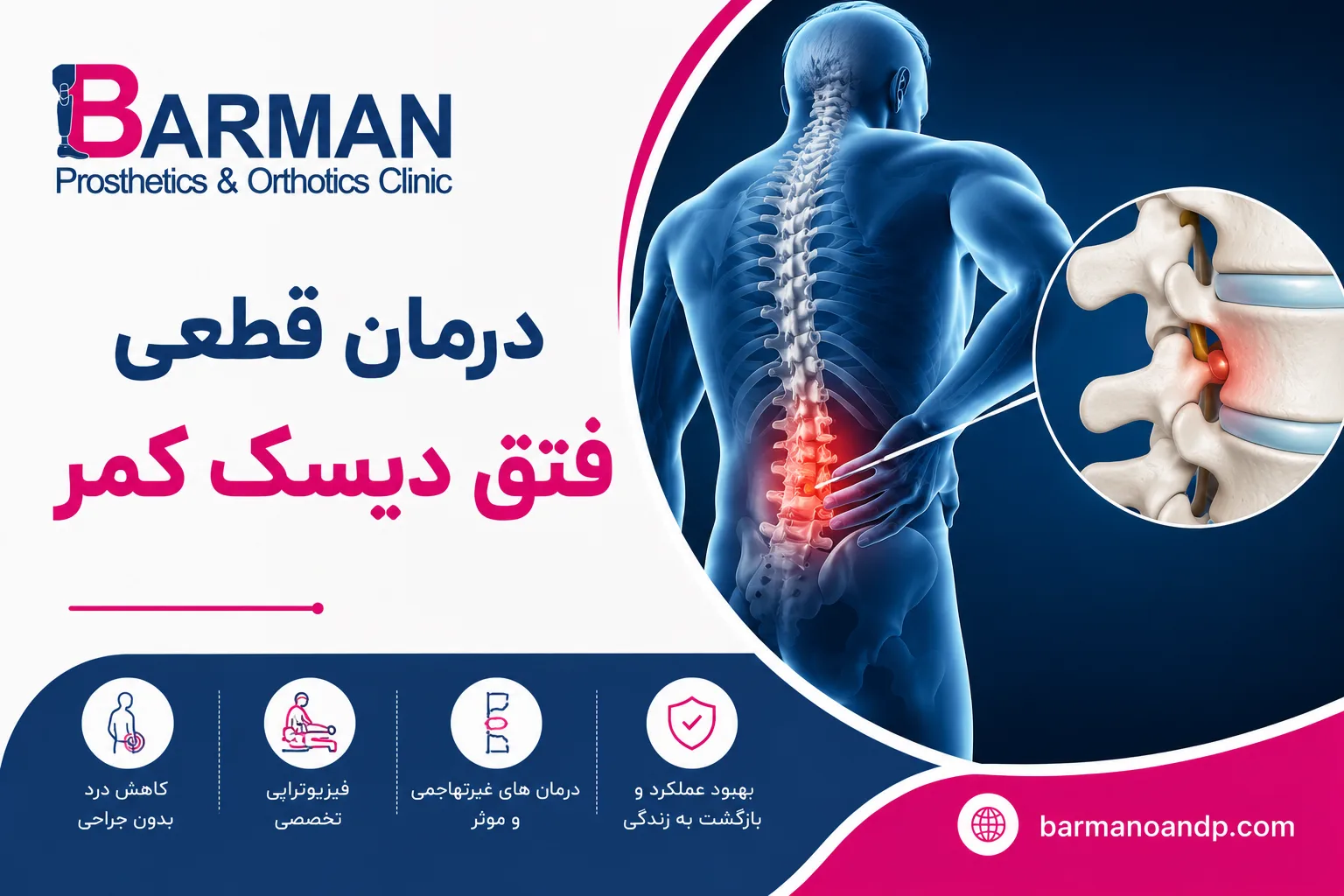 درمان قطعی فتق دیسک کمر